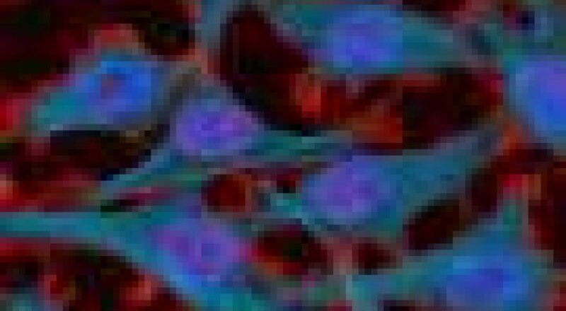 Surveillance active des lésions cervicales liées au risque accru de cancer du col de l&rsquo;utérus : comprendre et prévenir