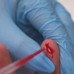 Le VIH désormais traité comme le paludisme grâce aux avancées médicales – Entretien avec le Pr Tih Pius