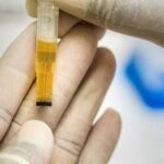 Comprendre la couleur de l’urine : guide complet et accessible
