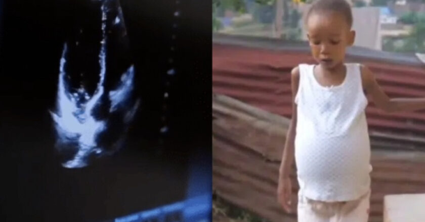 Choc et indignation: grossesse précoce d’une fillette de 6 ans au Nigéria, les réactions enflamment la toile!