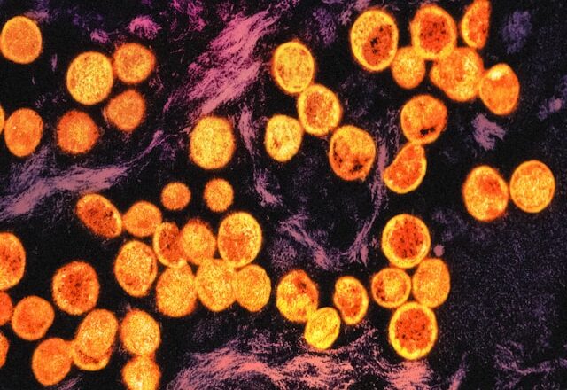 L’OMS sonne l’alarme: Le Mpox devient une menace mondiale pour la santé