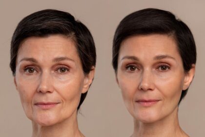 Transformation « Avant et Après » : Pourquoi Ces Images Captivent Notre Attention ?