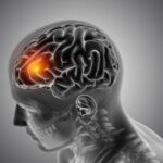 Un AVC survient toutes les 40 secondes : ce nutriment simple pourrait vous protéger