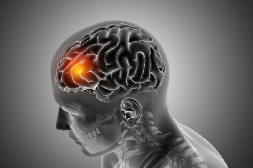Un AVC survient toutes les 40 secondes : ce nutriment simple pourrait vous protéger